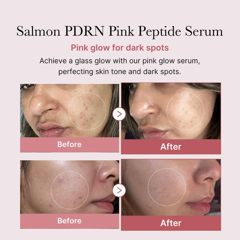 Medicube [NEW] PDRN Pink Peptide Brightening Glow Serum 30ml